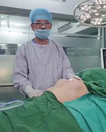 CA CHỈNH SỬA NÂNG NGỰC ĐÃ TỪNG TIÊM FILLER.