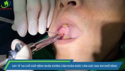 ĐỪNG ĐỂ RĂNG KHÔN LÀM HỎNG RĂNG SỐ 7