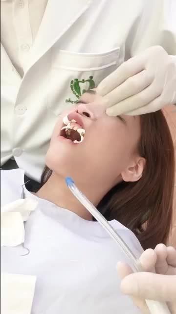 THẨM MỸ RĂNG SỨ ƯU ĐÃI SỐC ĐẾN 70% CƠ HỘI SỞ HỮU NỤ CƯỜI RẠNG NGỜI VỚI GIÁ CỰC ƯU ĐÃI CHỈ TRONG THÁNG NÀY