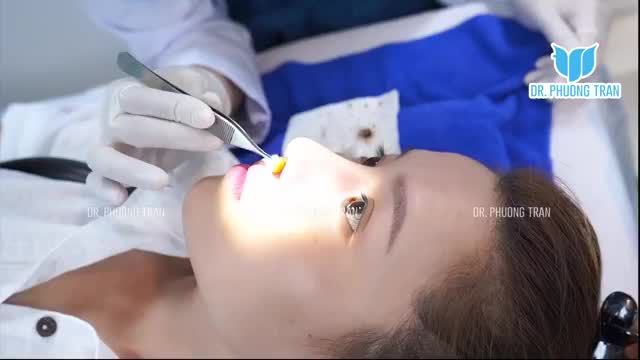 NGAY LÚC NÀY TẠI TRUNG TÂM HẬU PHẪU CHUYÊN SÂU