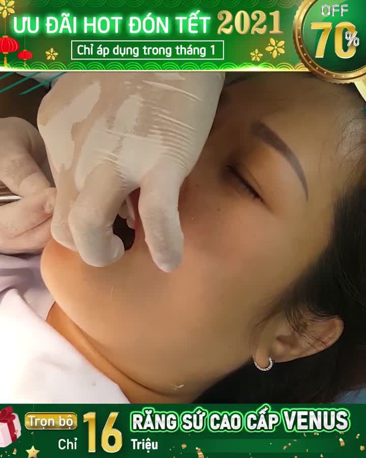 TRẺ TRUNG HƠN, TƯƠI TẮN HƠN NHỜ THAY ĐỔI NỤ CƯỜI