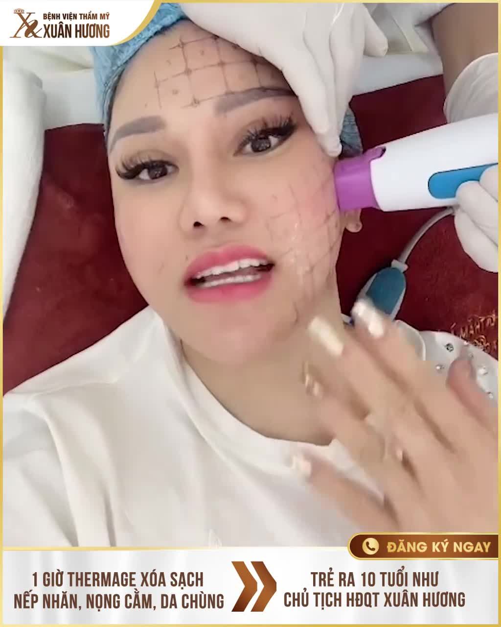 CHỌN THERMAGE 4.0 FLX  PHỤC HỒI VẺ ĐẸP NGUYÊN BẢN CỦA LÀN DA, LÃO HÓA TRỞ NÊN VÔ HÌNH