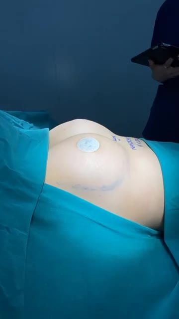 "HỒI SINH" VÒNG 1 CĂNG TRÒN NHỜ NÂNG CẤP VÒNG 1