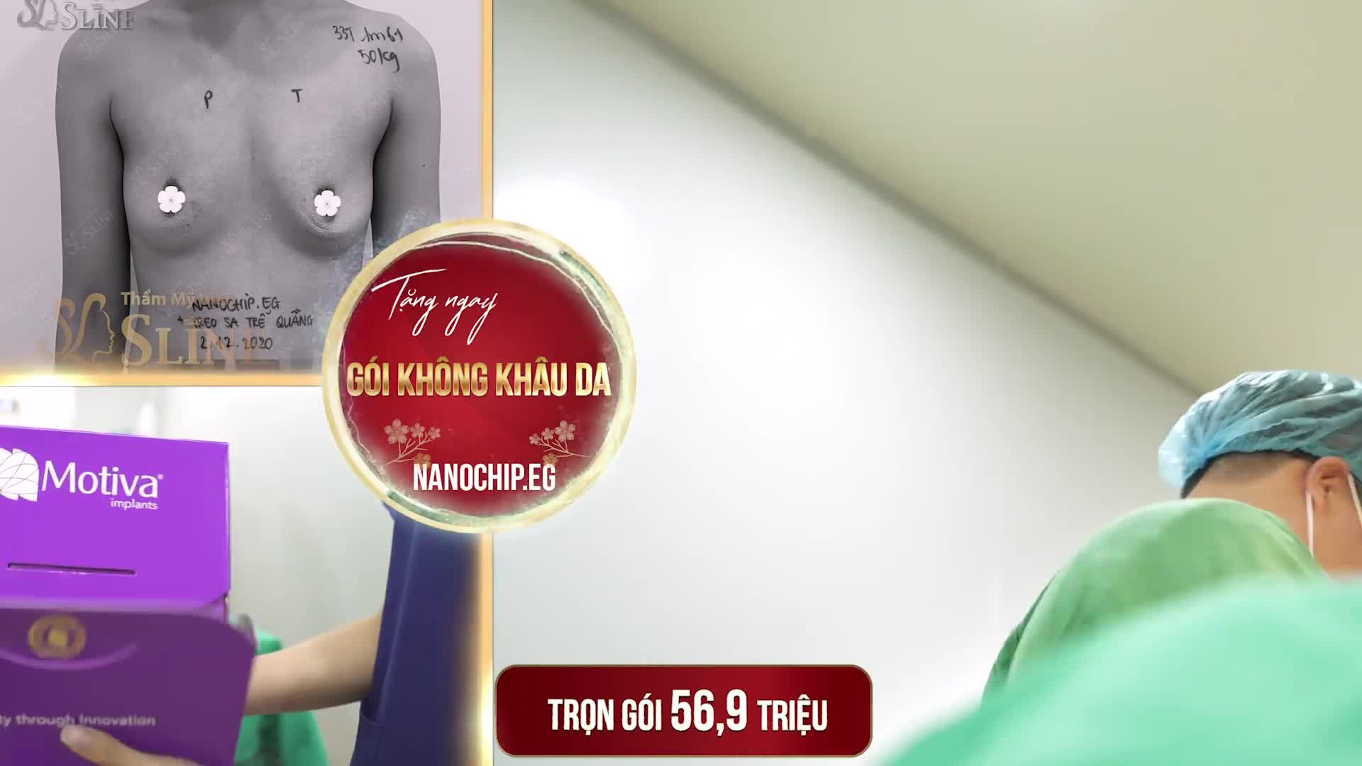 KẾT QUẢ" Treo sa trễ kết hợp đặt túi Nanochip Eg".