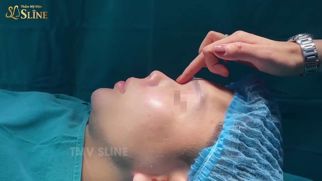 HÌNH ẢNH TRƯỚC CA MŨI “SIÊU KHÓ”