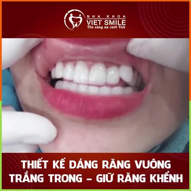 BẠN MONG MUỐN NỤ CƯỜI THẾ NÀO?