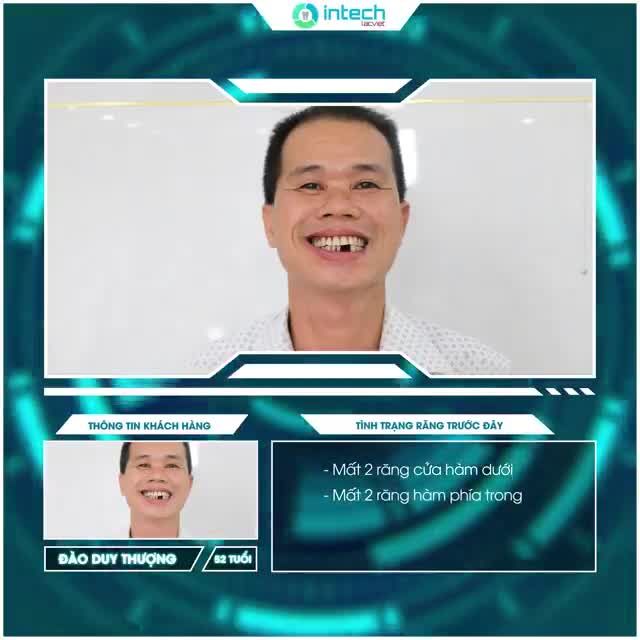 CHÚ RẤT VUI! TỪ GIỜ CÓ THỂ ĂN NHAI THOẢI MÁI RỒI!