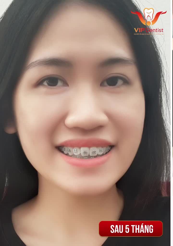 Chứng kiến sự thay đổi trên nụ cười của khách hàng là niềm hạnh phúc của chúng tôi!