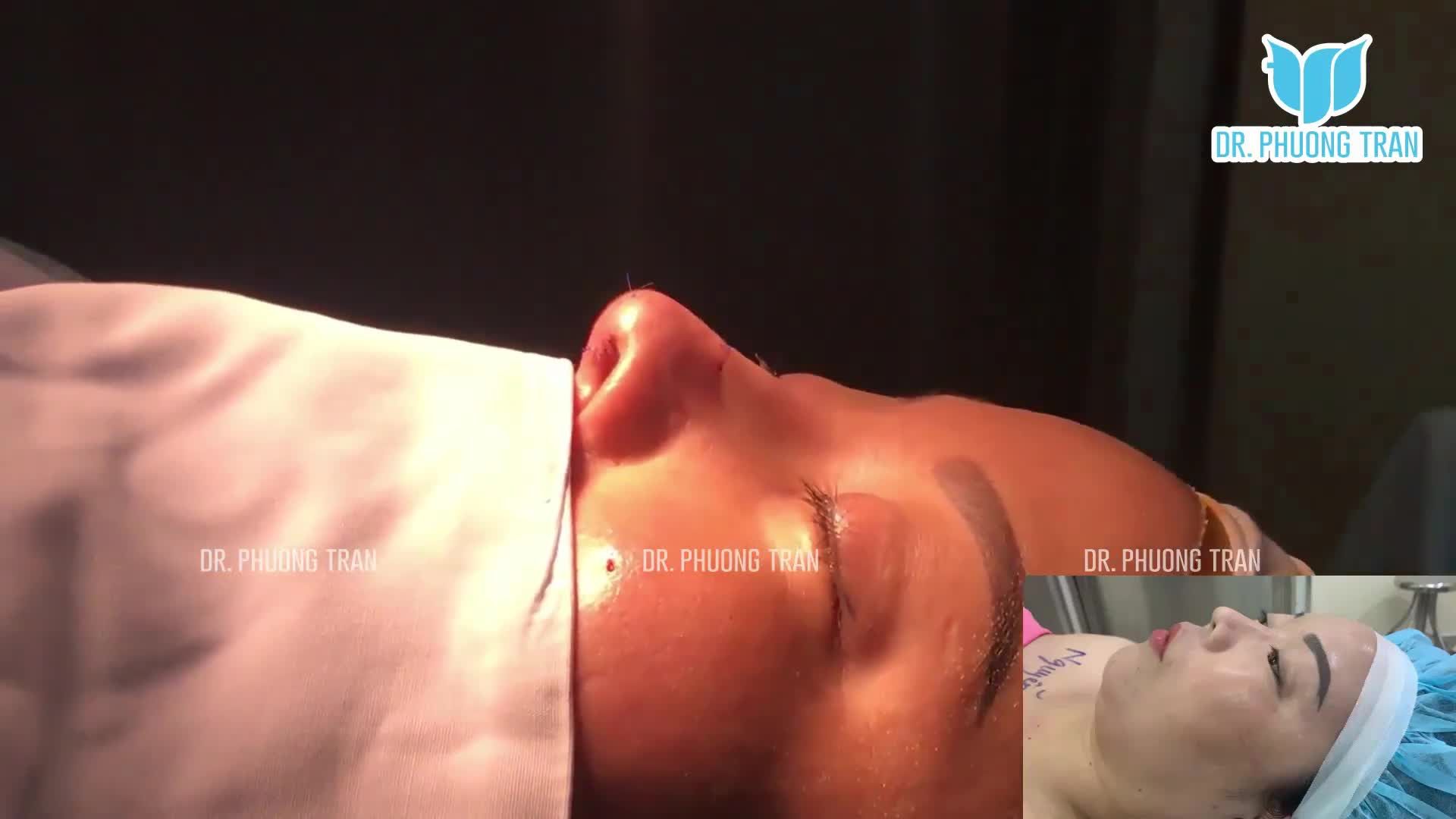 Đầu năm xin được “khoe” 1 bạn khách tên Xuân