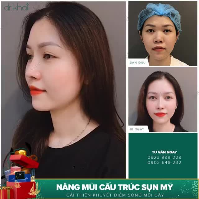 MŨI BỘ PHẬN QUYẾT ĐỊNH 80% NHAN SẮC