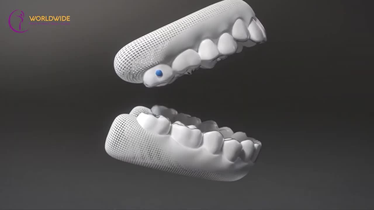 Với khay niềng trong suốt nên những người đối diện sẽ không biết bạn đang mang niềng răng!