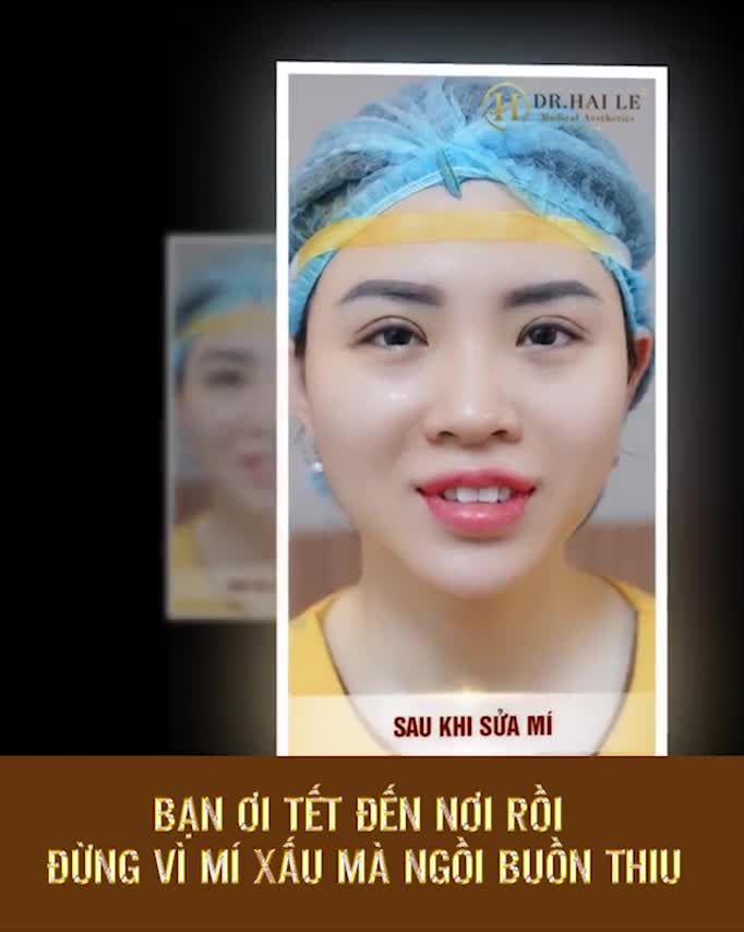 2 MÍ “SIÊU” NÉT MẶT XINH SẮC SẢO