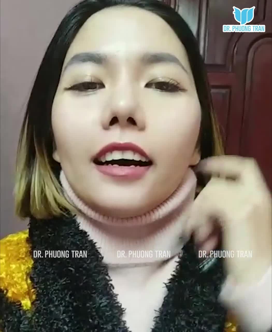 CÔ ĐIỀU DƯỠNG XINH ĐẸP REVIEW KẾT QUẢ THỰC TẾ SAU 6 THÁNG NÂNG MŨI SỤN SƯỜN ĐỘN CẰM