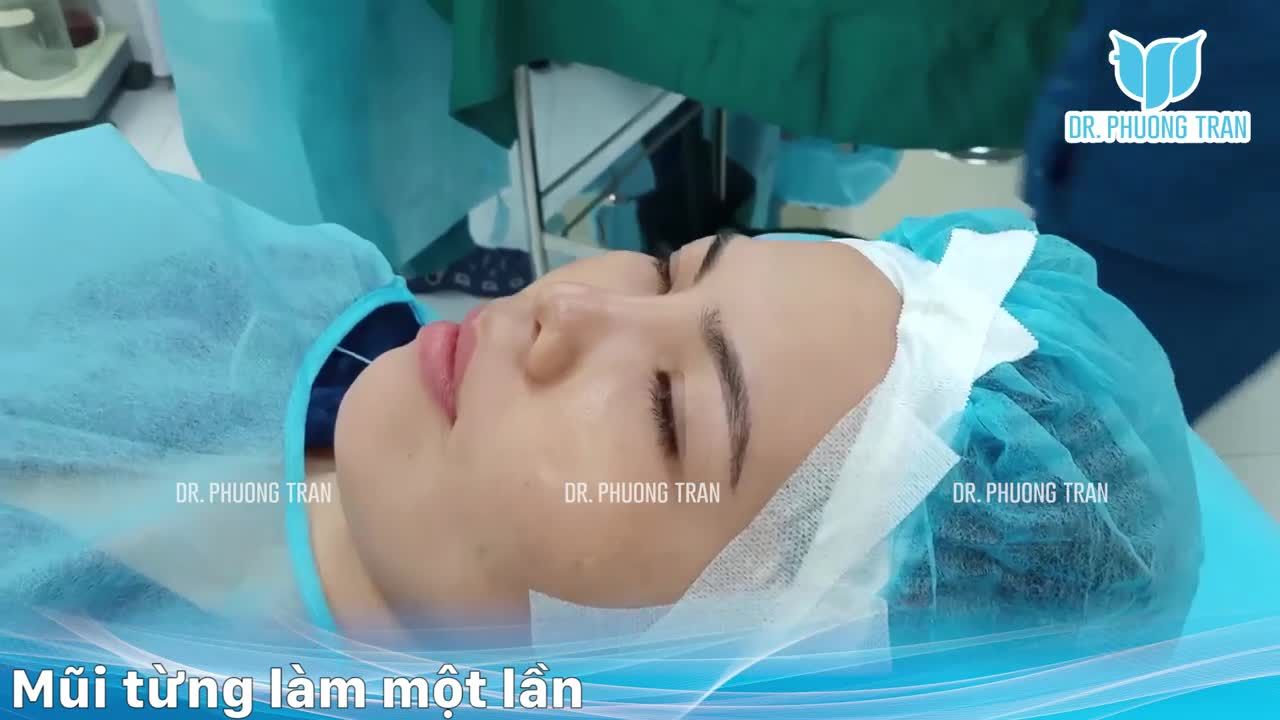 Mũi đẹp không khó có bác sĩ đây