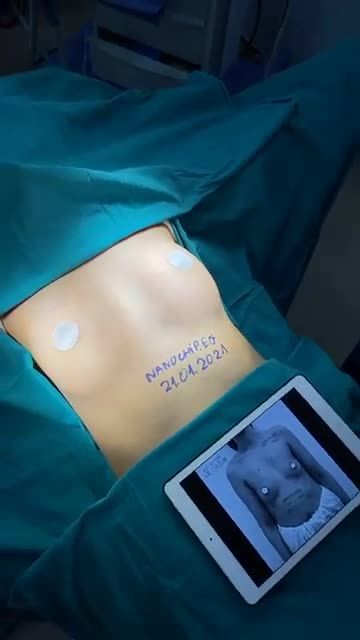 VÒNG 1 TRÒN XINH RINH NGAY QUÀ HOT