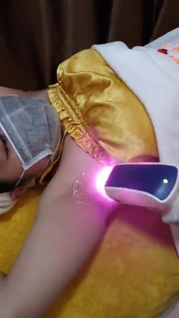 Cận cảnh quy trình TRIỆT LÔNG Diode Laser vĩnh viễn