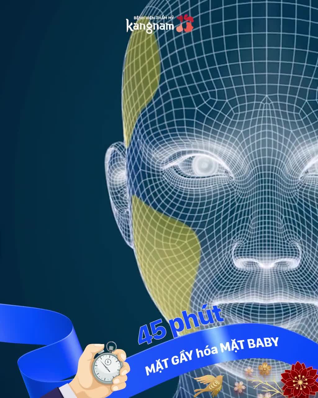 Cấy mỡ Nanofat Lấp đầy hốc hác không phẫu thuật