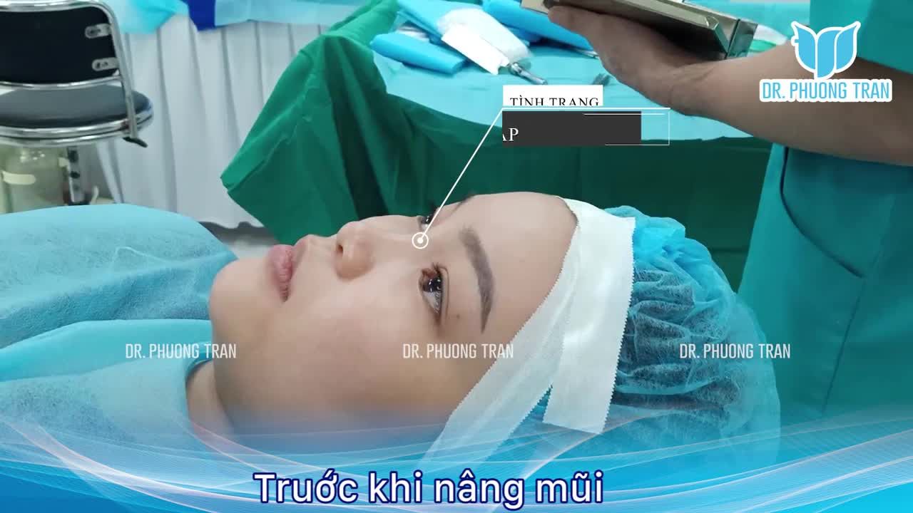 Mũi thấp gãy và cuộc “lội ngược dòng” ngoạn mục