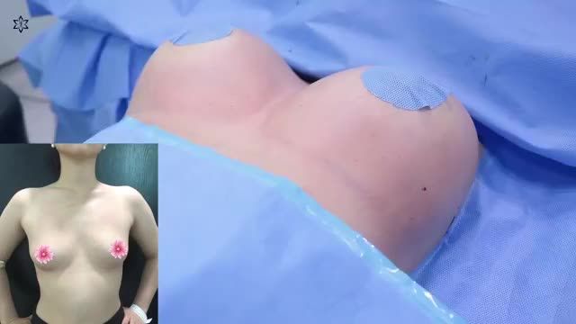GIẢI PHÁP DÀNH CHO NGỰC "BỨC TƯỜNG" NHANH CHÓNG KHÔNG ĐAU LÂU BỀN