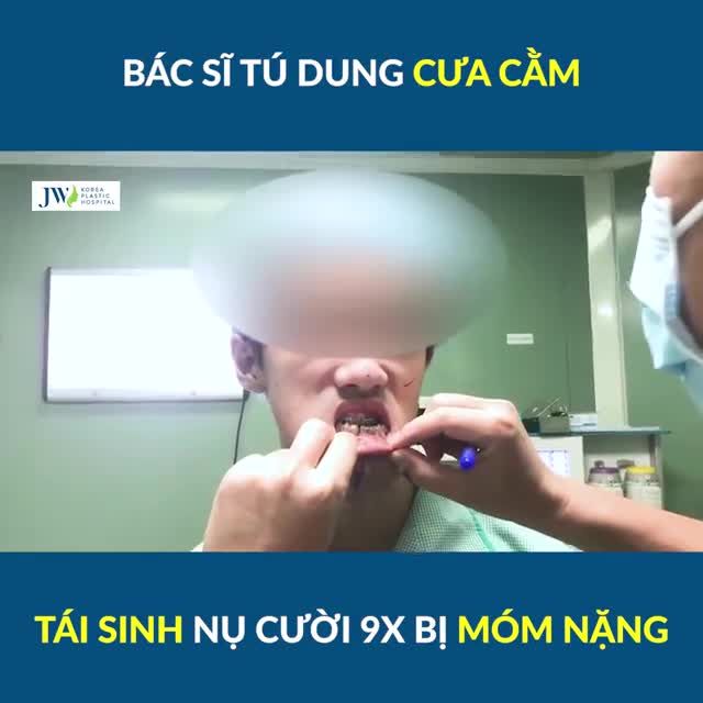 Mãn nhãn Bác sĩ Tú Dung CƯA HÀM, TÁI SINH nụ cười cho 9X HÀM MÓM NẶNG