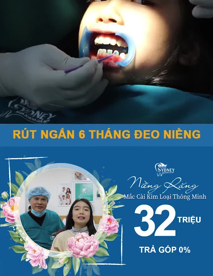 NIỀNG RĂNG ĐẦU NĂM, CUỐI NĂM THÁO NIỀNG CÙNG MẮC CÀI KIM LOẠI