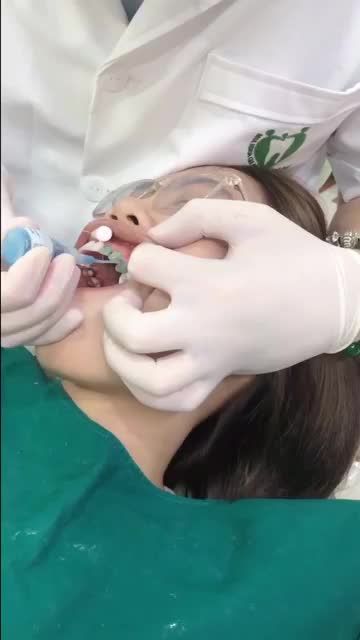 THẨM MỸ TRỌN BỘ 16 RĂNG CHỈ 3,2TR  ƯU ĐÃI CHƯA TỪNG CÓ TỪ TRƯỚC ĐẾN NAY