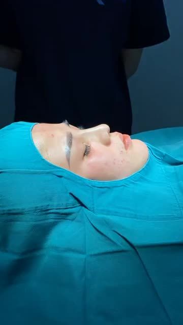 NÂNG MŨI ĐẸP XINH LUNG LINH ĐÓN TẾT