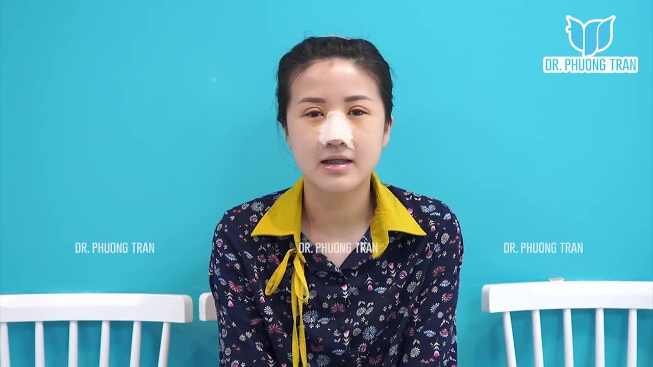 KHÁCH HÀNG REVIEW SAU 5 NGÀY NÂNG MŨI CẮT MÍ: "AI CŨNG KHEN MẮT VÀ MŨI CỦA MÌNH ÍT SƯNG"