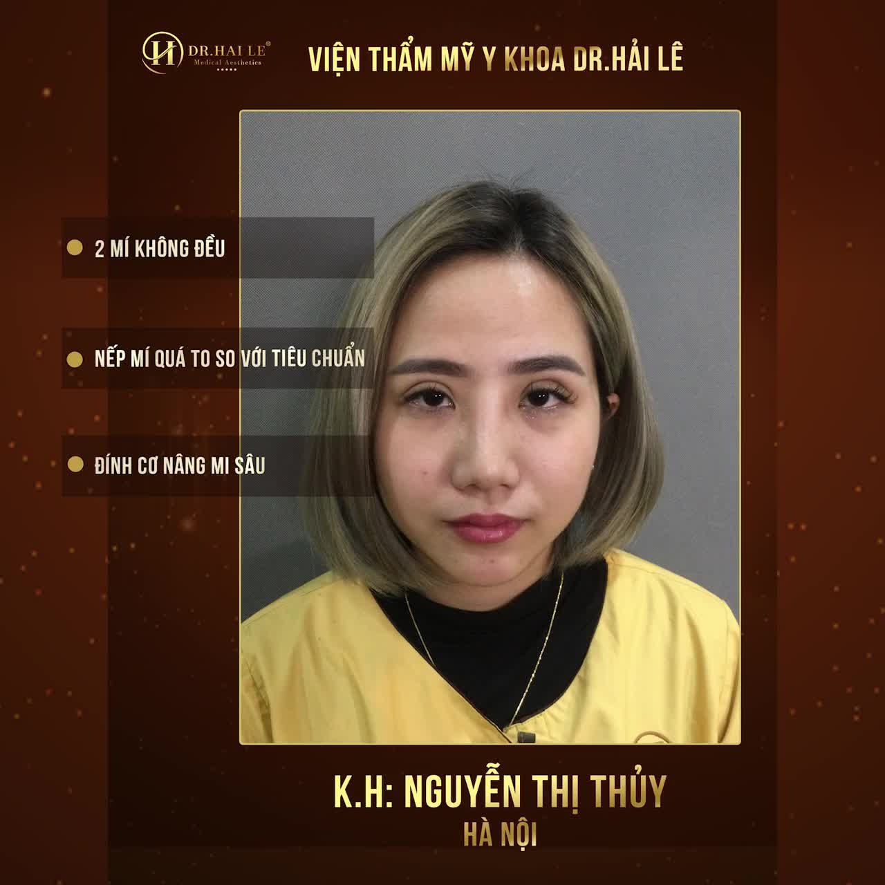 Nhà tôi 3 đời thích livestream Đến đời tôi thì ngại vì mắt xấu, lỗi, hỏng