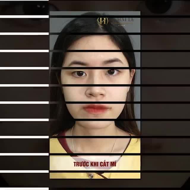 Bạn có thích nếp mí mới này không? Thích chứ Thích nhiều không? Nhiều đến mức lúc nào cũng muốn soi gương để tự ngắm nhìn mình