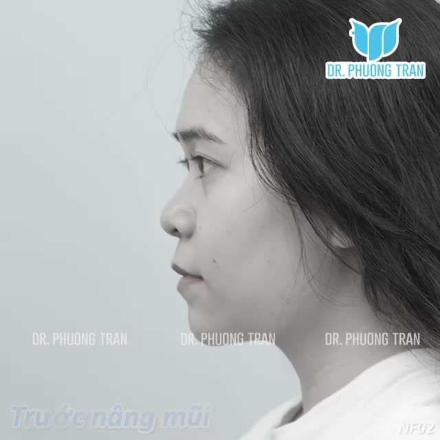 EM HÀI LÒNG VÌ ĐÃ ĐẶT NIỀM TIN ĐÚNG NƠI, ĐÚNG BÁC SĨ