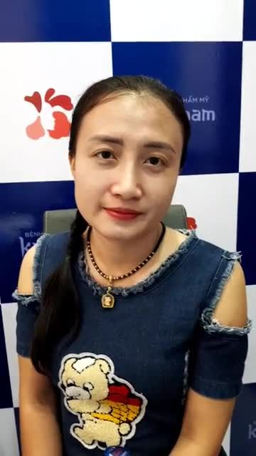 Nâng mũi cấu trúc 4D kịp Tết 10 ngày mũi đẹp tự nhiên
