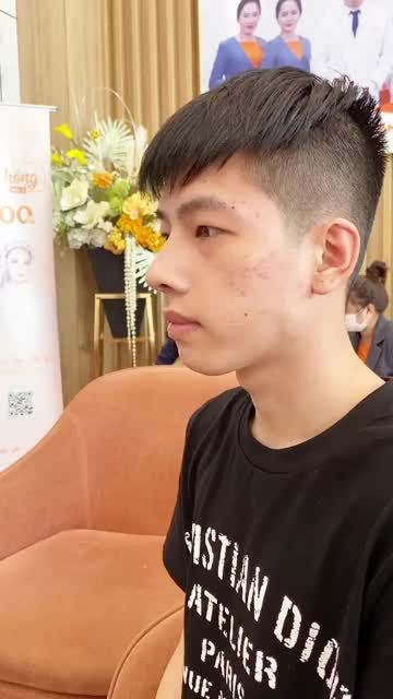 Thay đổi 100% chỉ sau 17 ngày nâng mũi