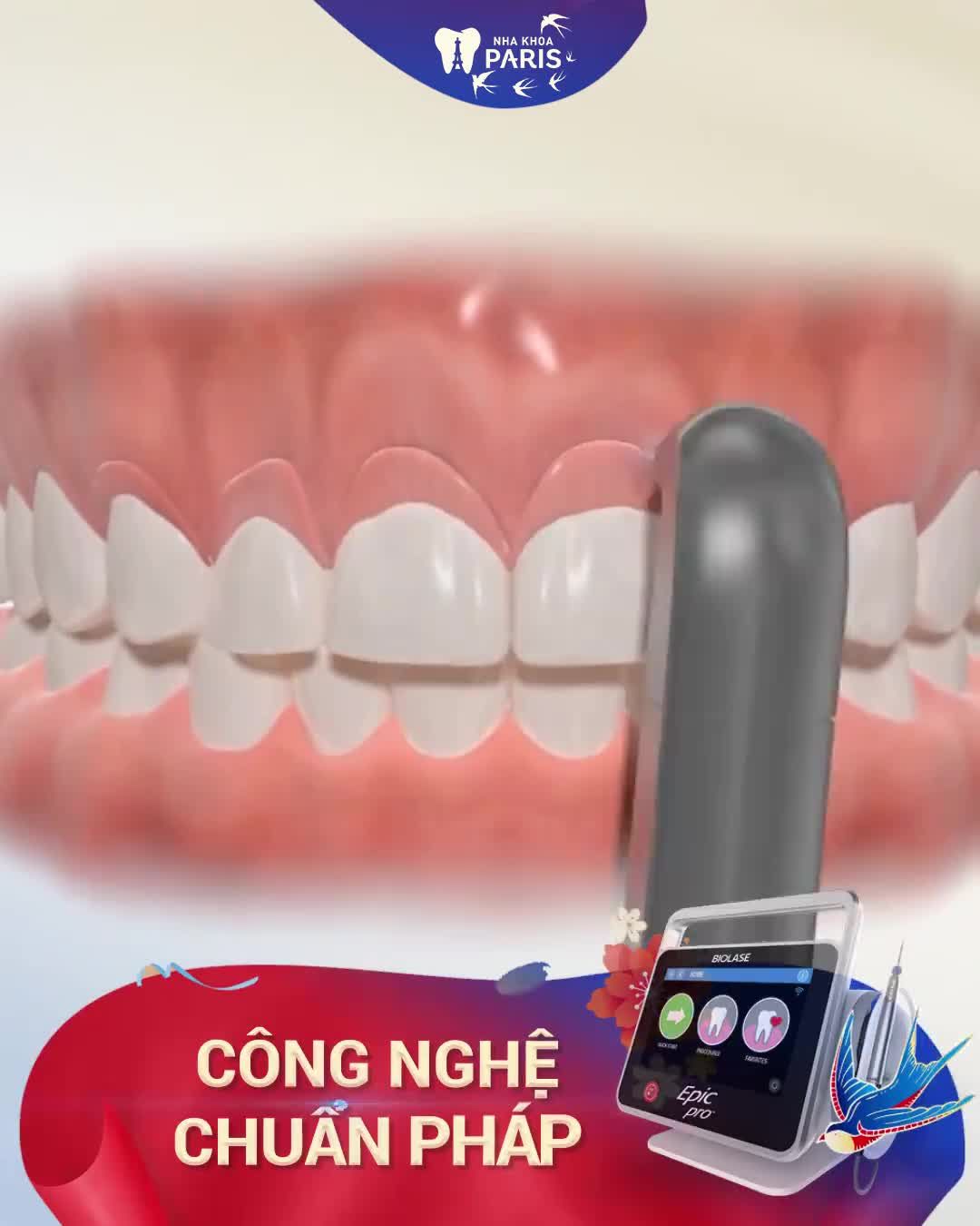 Cười thả ga, Deal to đón Tết