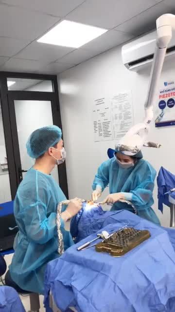NÂNG XOANG VÀ CẤY GHÉP 01 TRỤ IMPLANT HÀN QUỐC TẠI NHA KHOA PARIS QUẢNG NINH