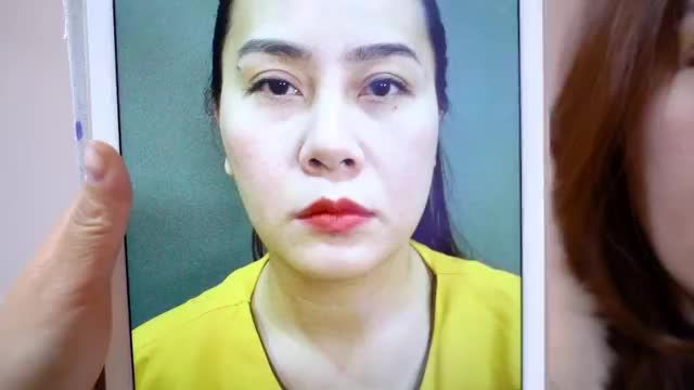 Cận cảnh khách hàng chia sẻ hình ảnh và cảm nhận sau khi Sửamí thành công tại Dr.Hải Lê