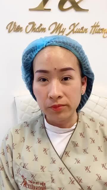 CHỦ TỊCH HĐQT XUÂN HƯƠNG CHIA SẺ CÙNG KHÁCH HÀNG VỪA THỰC HIỆN NHẤN MÍ PHUN MÀY TẠI BVTM XUÂN HƯƠNG