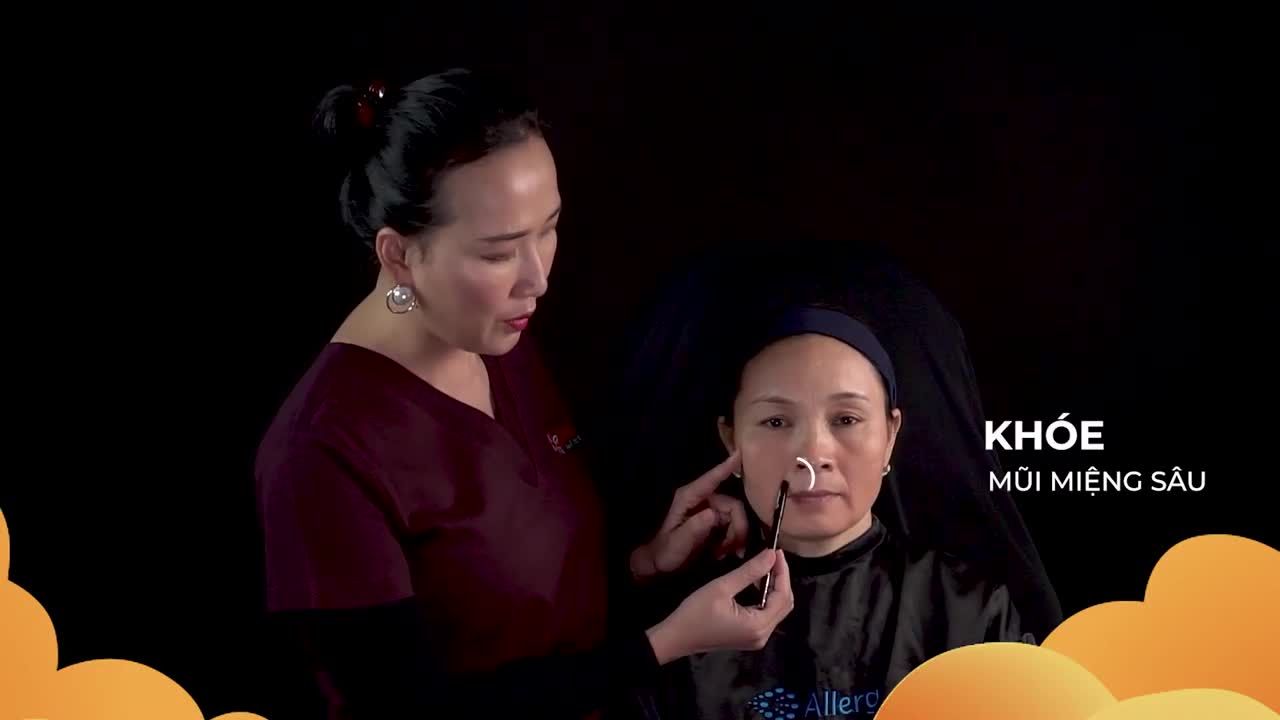 FILLER MD DYNAMIC CODES GIẢI PHÁP TOÀN DIỆN TRONG ĐIỀU TRỊ CHẢY XỆ KHUÔN MẶT