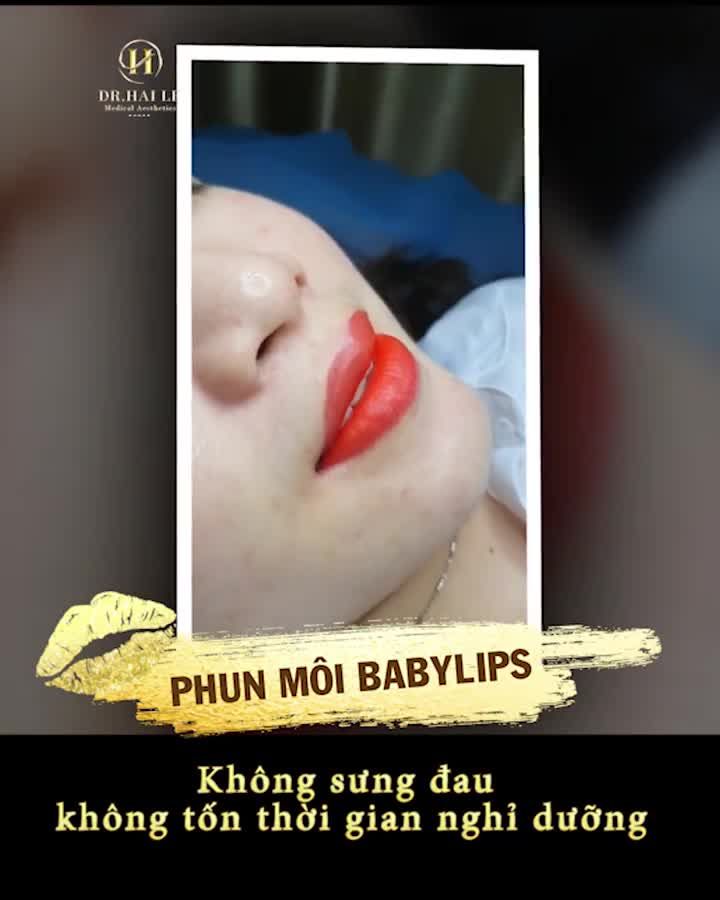 Cận cảnh một đôi môi đẹp mê ly vừa được Dr.Hải Lê sử dụng công nghệ phun môi phủ bóng BabyLips!
