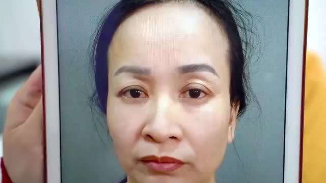 Tình trạng của chị gái: da nhiều, thiếu mỡ; hốc mắt sâu u buồn.