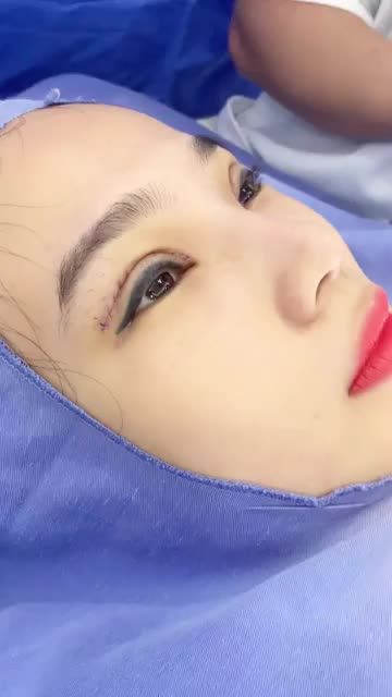 Combo MŨI MÍ chưa bao giờ hết "hot"