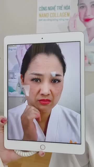 'Vừa Căng Chỉ BIOLIFT nửa mặt xong, Ms Doanh nhân Bảo Ngọc phải thốt lên “Hết nhăn thật rồi, nhìn rạng rỡ trẻ trung hơn hẳn, làm nốt mặt còn lại cho chị đi”