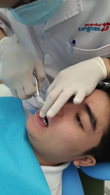 Anh Thanh Niên " Cười Đẹp Chuẩn Soái Ca" sau NIỀNG RĂNG