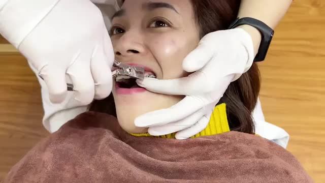 BUNG LỤA CHO KHÁCH HÀNG NGÔ THỊ BƯỞI 1993 RĂNG HÔ  KHẤP KHỂNH