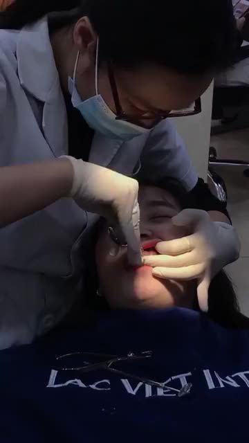 CẢM XÚC VỠ OÀ KHI THÁO MẮC CÀI SAU 2 NĂM ĐEO NIỀNG