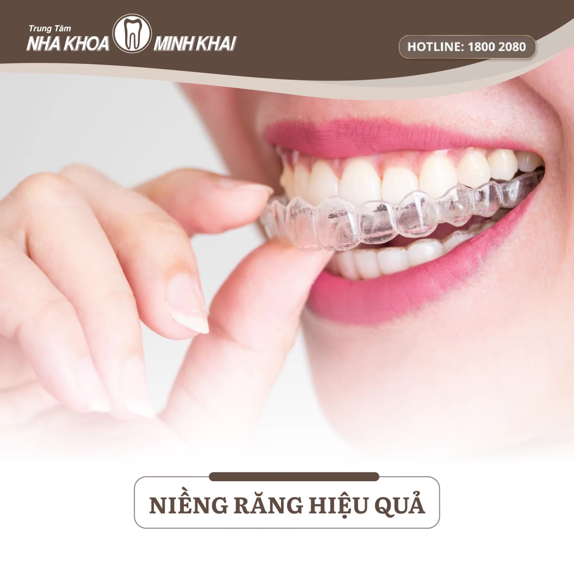 CLEAR ALIGNER NIỀNG RĂNG QUỐC DÂN, KHÔNG LẤN CẤN VÌ SỢ XẤU