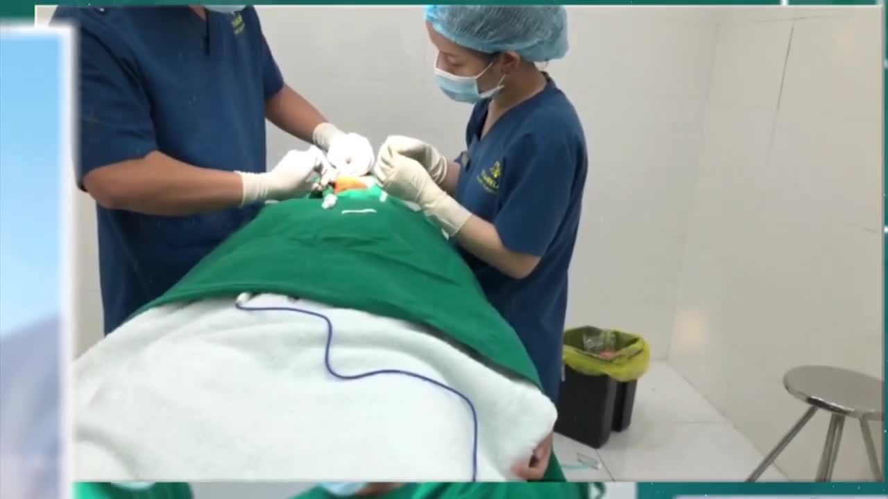 THẨM MỸ NÂNG MŨI 5.0