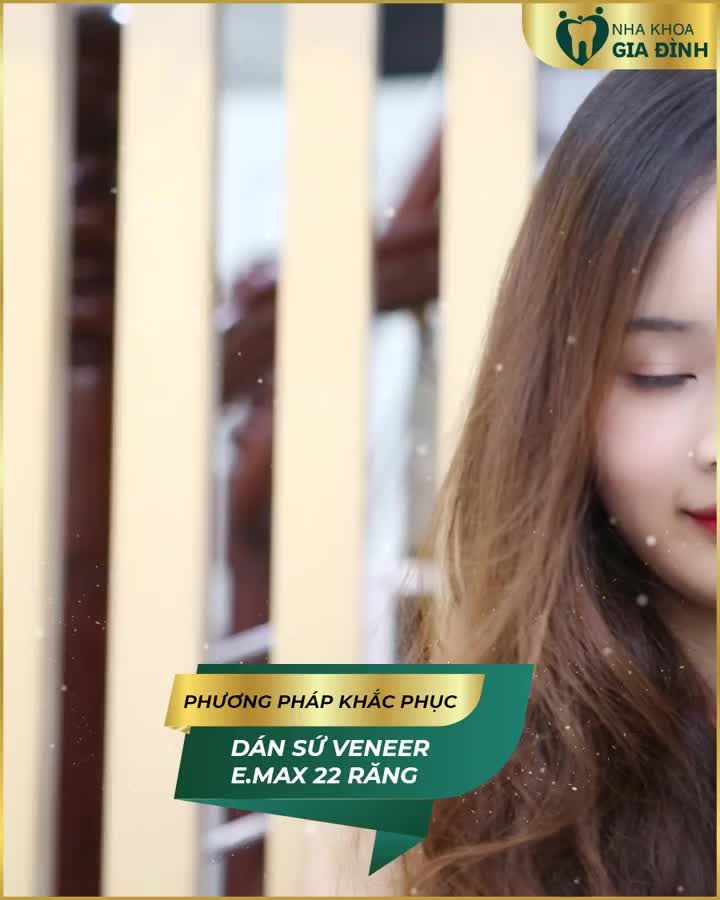 THAY RĂNG ĐỔI VẬN NIỀM VUI BẤT TẬN
