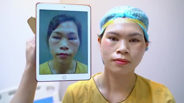 Trẻ hóa đôi mắt nhờ Combo Nâng cung mày+Cắt mí dưới trong ngày đầu năm mới! Nhìn là thích, ngắm là mê!