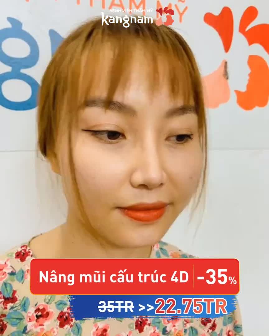Bảng giá NÂNG MŨI ở thời điểm hiện tại ra sao???